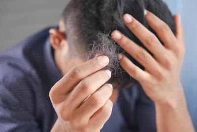CBD for Hair Loss: Does it Actually Work?